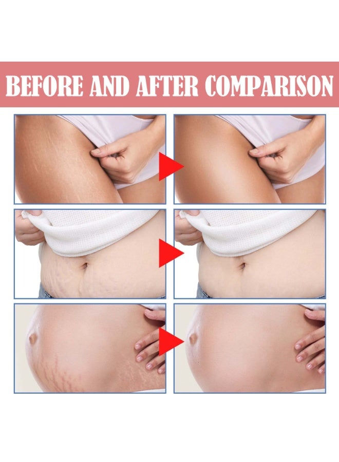 Wiieey Postpartum Repair Massage Cream 50ml is specially formulated for pregnant and postpartum skin. It gently nourishes and smooths skin, improves elasticity, and firms the abdomen. - Image 5